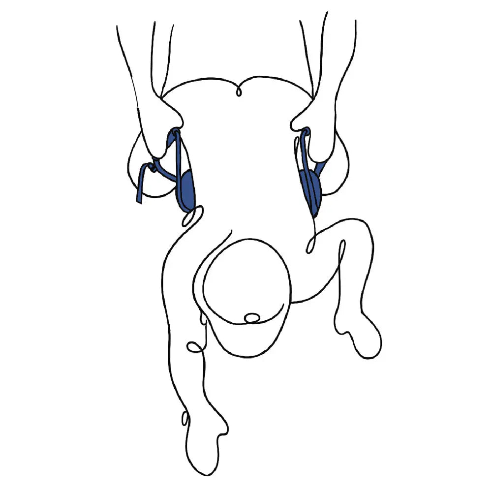 Pivot Deluxe Doggie Strap -  Position Harness Strap Sportsheets Discreet Intimate Essentials.